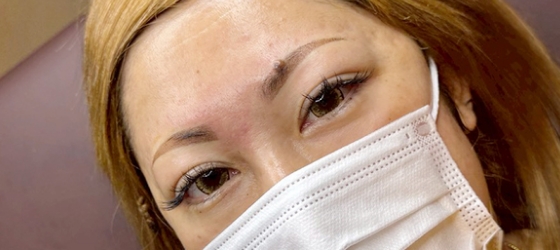 アートメイク後d