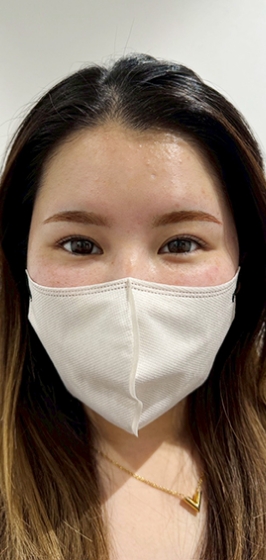 アートメイク後f