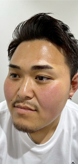 アートメイク後g