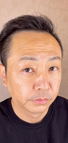 アートメイク後h