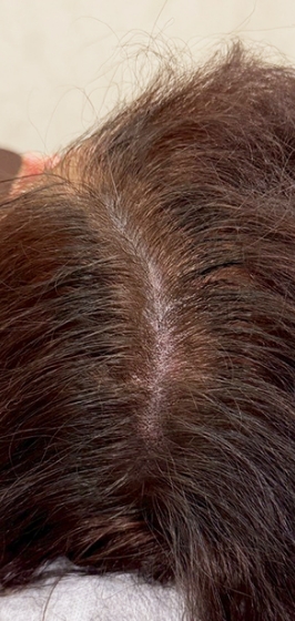 ヘアシャドウアートメイク後d