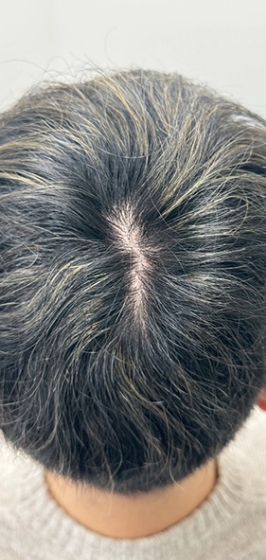 ヘアシャドウアートメイク前a