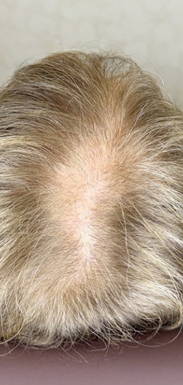 ヘアシャドウアートメイク前c