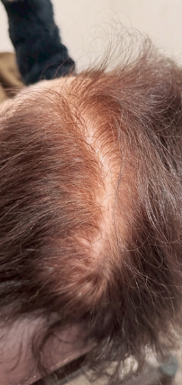 ヘアシャドウアートメイク前d